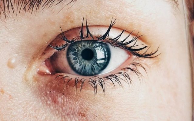 Perché vengono le occhiaie nerissime e cosa sapere sulle possibili cause